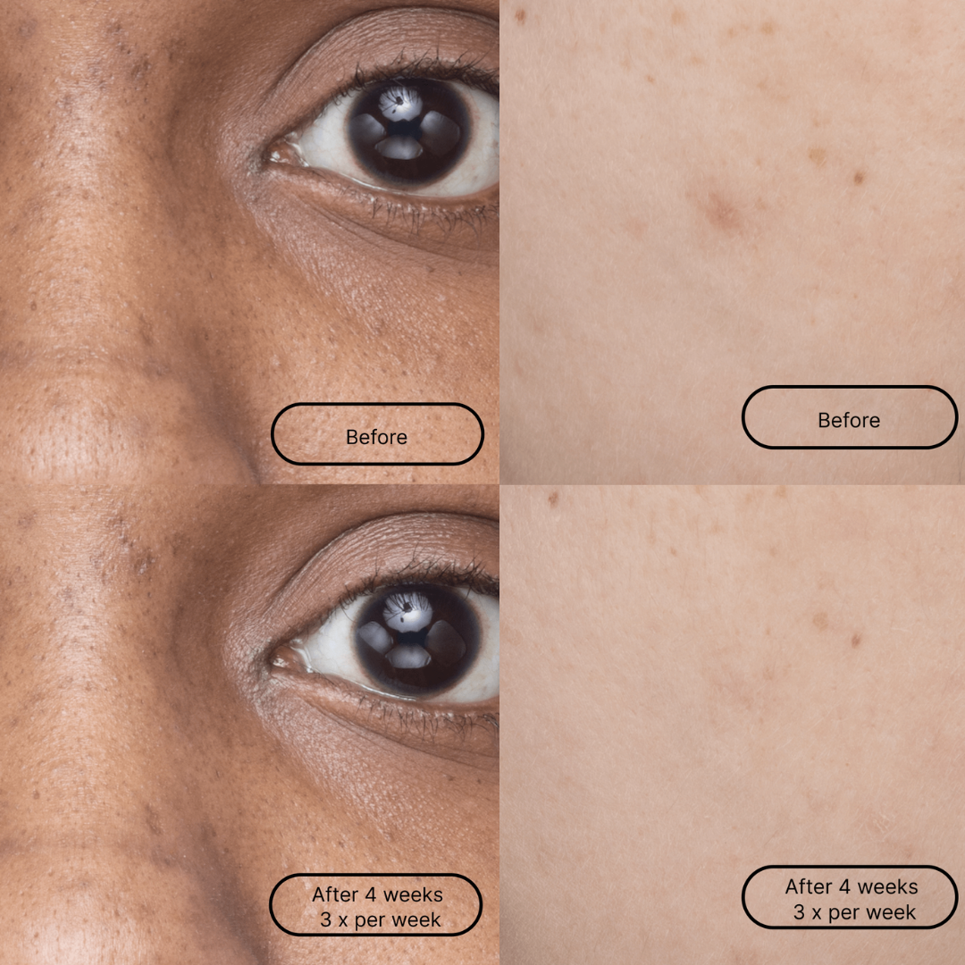 Hyper Smooth Single Mask